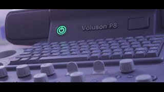 Voluson P8 overview [upl. by Rosenfeld]