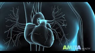 Coronary Angiography amp Cardiac Catheterization — AMITA Health [upl. by Okimuk695]