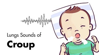 Sounds of Croup Laryngotracheitis  Lung Sounds  MEDZCOOL [upl. by Knorring]