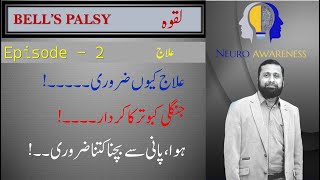 Bells Palsy Treatment  Myths amp Reality لقوہ کا علاج۔  Dr Ali Hassan [upl. by Liamsi514]