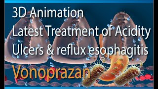 3D Animation Latest Treatment for Gastric amp duodenal ulcer GERD esophagitis Vonoprazan vs PPI MOA [upl. by Assyle]