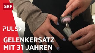 Arthrose Was hilft gegen den schmerzhaften Knorpelabbau in Knie und Hüfte  Puls  SRF Wissen [upl. by Honorine854]