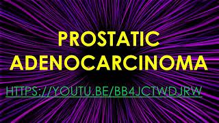 PROSTATIC ADENOCARCINOMA [upl. by Bibbye]