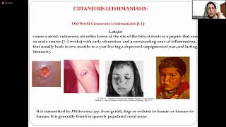 Leishmaniasis amp Cystisercosis  3rd Year  Infectious Diseases Module  Clinical Medicine [upl. by Nofpets828]