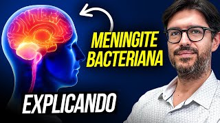 Meningite Bacteriana  O Que é Meningite Bacteriana [upl. by Funda868]