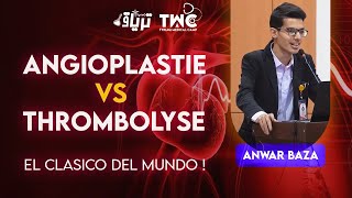 CARDIOLOGIE  Angioplastie VS Thrombolyse  Anwar Baza [upl. by Helmut]