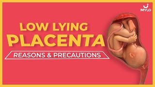 Low Lying Placenta How To Cure Low Lying Placenta Naturally  Mylo Family [upl. by Shirlie]