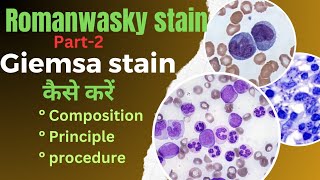 Giemsa stain procedureromanwasky stain in hematologyBlood film preprationamp identification of cells [upl. by Airdnassac]