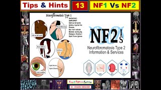 NF1 Vs NF2 Tips amp Hints 13 [upl. by Nappie]