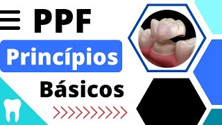 PRINCÍPIOS BÁSICOS para a CONFECÇÃO da PRÓTESE FIXA [upl. by Nitnerb14]