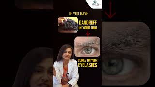 5 Causes Stye on Your Eyelid   How To Get Rid Of Stye From Eye  Vision Eye Centre [upl. by Palila]