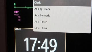 Clock in Intellivue monitor [upl. by Greeson25]