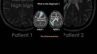 The clinical question MRI Quiz 27 radiologychannel007 [upl. by Ynad213]