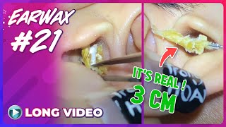 EP 21 Earwax ASMR Remove earwax to hear the world talk more clearly in full HD mode [upl. by Annuhsal]