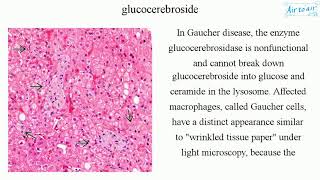 glucocerebroside [upl. by Abott544]