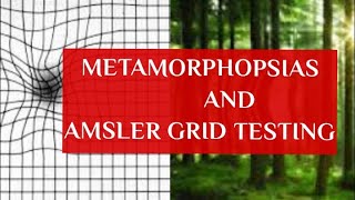 METAMORPHOPSIAS and AMSLERS GRID TESTING [upl. by Hardej795]