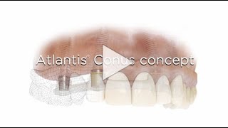 Atlantis Conus concept [upl. by Ynneh]