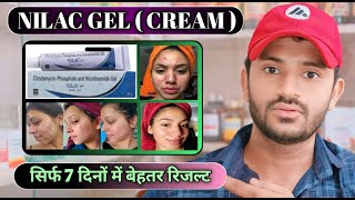 Nilac gel uses in hindi how to use nilac gel [upl. by Donall]