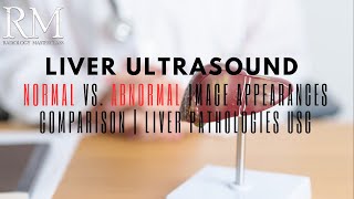 Liver Ultrasound Normal vs Abnormal Image Appearances Comparison  Liver Pathologies USG [upl. by Hillary]