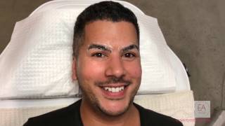 Mens Eyebrow Microblading Melbourne Victoria  Eye Art Studio [upl. by Aray]