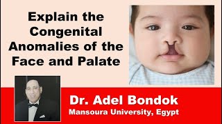 Explain the Congenital Anomalies of the Face and Palate Dr Adel Bondok [upl. by Olly820]