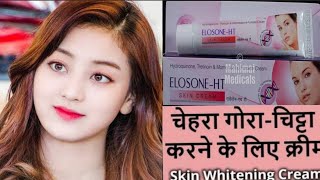 डॉक्टर द्वारा दी गई No1 Fairness Cream सबसे अच्छी और सस्ती Skin Whitening Cream  Elosone Ht Cream [upl. by Danete]