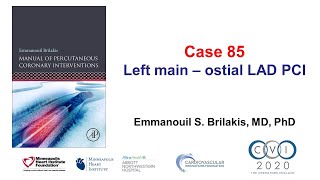 Case 85 PCI Manual  Ostial left mainLAD bifurcation stenting [upl. by Harve]