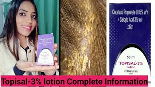 Topisal3 Lotion reviewuses and sideeffects complete information StyleWithRuchi [upl. by Nahtnamas546]