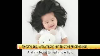 NDT Baby Chanco becomes Pantene model [upl. by Remas52]