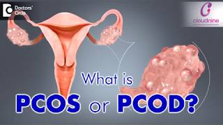 What is PCOS or PCOD  Dr Bandita Sinha of Cloudnine Hospitals  Doctors Circle [upl. by Marina]