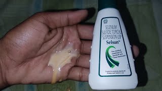 Selsun Shampoo Honest Review [upl. by Dory844]