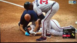 Braves Charlie Culberson Getting Hit in the Face [upl. by Akelahs36]