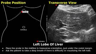 Abdominal Gynecological amp Obstetric Ultrasound Probe Positioning  Transducer Placement USG Scan [upl. by Anthe]