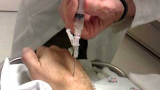 Ganglion Cyst aspiration  removal D [upl. by Hillier]