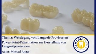 ZahntechnikGRATISWerdegang von Langzeitprovisorien [upl. by Nylzaj966]