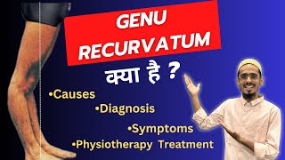 Genu recurvatum in Hindi  Causes  Diagnosis  Medical Treatment  Physiotherapy Treatment [upl. by Maroj]