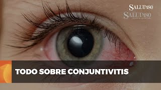 ✅ Todo sobre la conjuntivitis  Salud180 🌿 [upl. by Nnoryt]