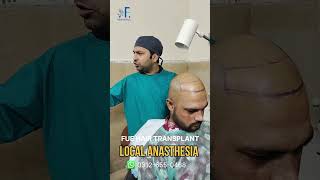 Local Anasthesia For FUE HAIR TRANSPLANTDr Faisal Hayat KhanBest Hair Transplant Clinic [upl. by Manella]