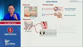 Hemorragia Obstétrica II Mitad Vasa Previa [upl. by Aslin656]