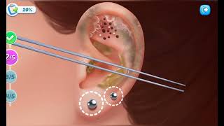 2item Ear infection cleaning  asmr  relaxing treatment [upl. by Elicul]