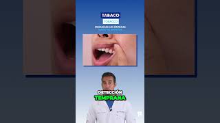 FUMAR favorece el DESARROLLO de la ENFERMEDAD PERIODONTAL  Otra razón para dejarlo [upl. by Gambell788]