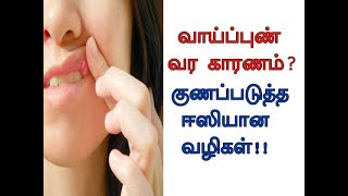 வாய்ப்புண் வர காரணம் குணமாக என்ன செய்வது  Mouth Ulcer Symptoms and Treatment in Tamil  Vaai pun [upl. by Paquito]