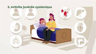 Qu’estce que l’arthrite juvénile idiopathique [upl. by Aziaf]