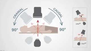 Mastering Coronary Angiography Image Intensifier amp Carm Fundamentals [upl. by Devad]