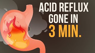 Reduce your Acid Reflux  Heartburn in just 3 Minutes 🔥 [upl. by Reilly]