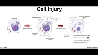 pathogenesis of cell injury [upl. by Aiuqram]