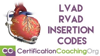 Review of LVAD RVAD Insertion Codes  Medical Coding Training [upl. by Bartko]