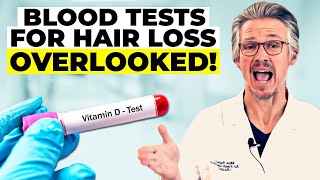 BLOOD TESTS FOR HAIR LOSS THE CRITICAL BLOOD TESTS YOU NEED NOW [upl. by Mylander]