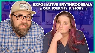 Exfoliative Erythroderma  Our Journey amp Story GRAPHIC IMAGES [upl. by Nyleimaj]