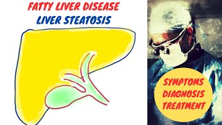 Fatty Liver Disease  Liver Steatosis [upl. by Zeeba]